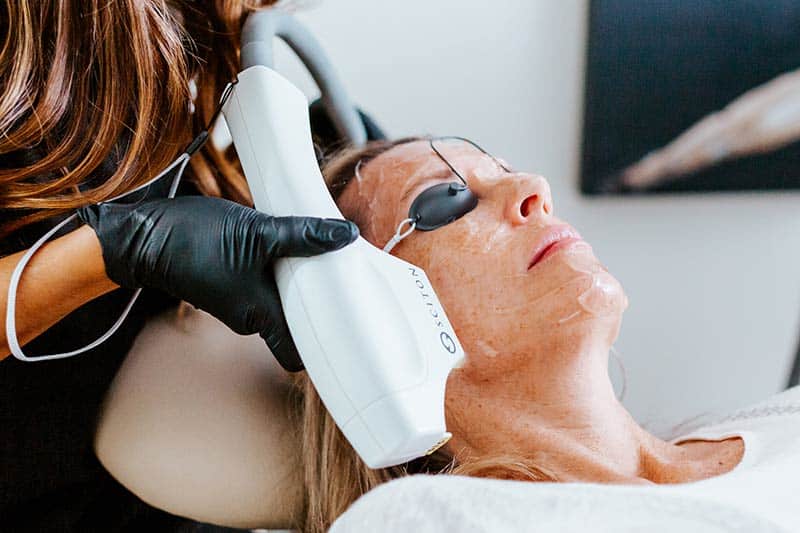 BBL Photofacial Laser Treatment for Skin Health at Arsenault Aesthetics in Lakewood Ranch FL