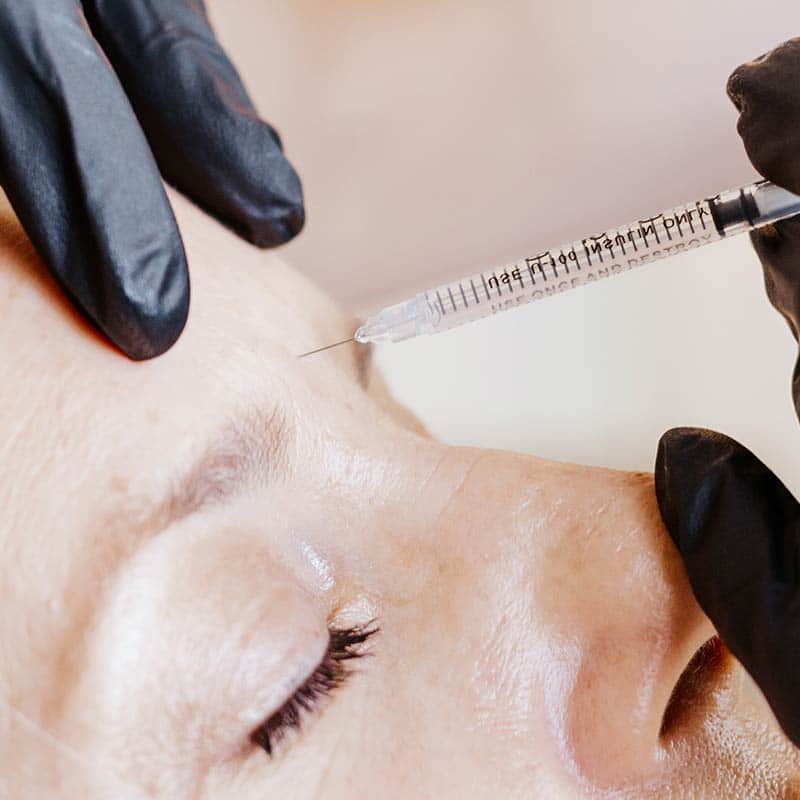 botox injection during botox treatment at Arsenault Aesthetics in Lakewood Ranch FL