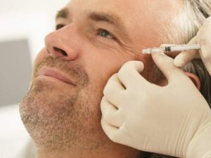 Men's Botox for Crows Feet