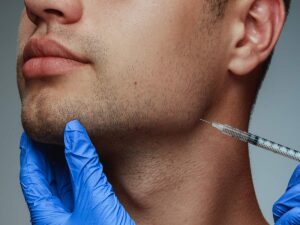 Mens filler in Jawline