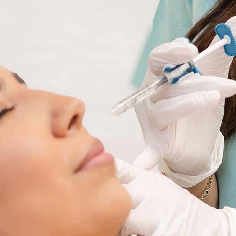 prf gel filler in lakewood ranch and venice florida