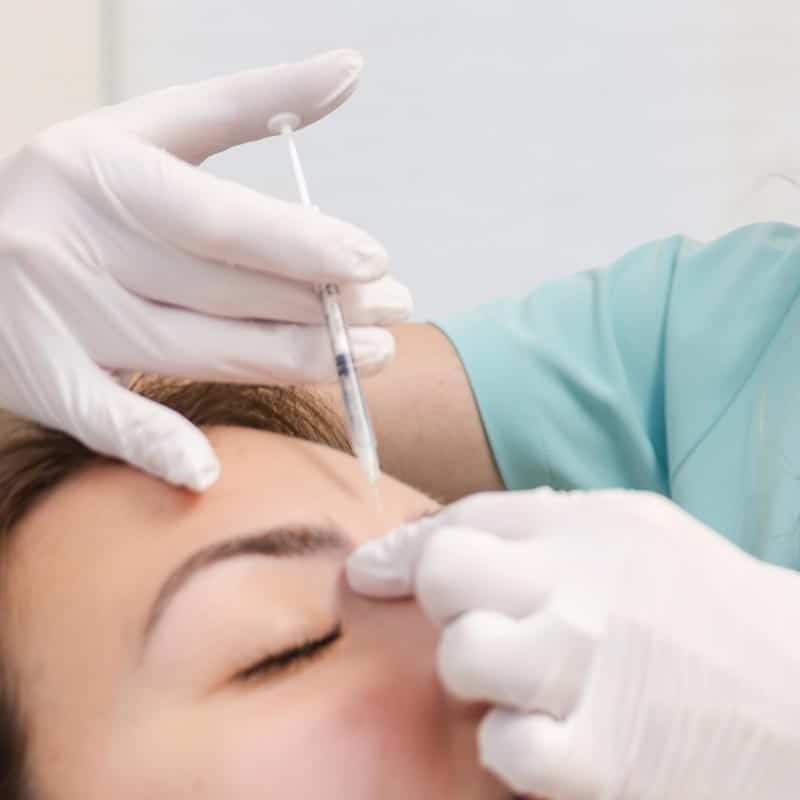 Sculptra Filler in Lakewood Ranch and Venice