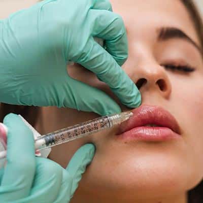 Dermal Fillers lip Filler in Lakewood Ranch Florida