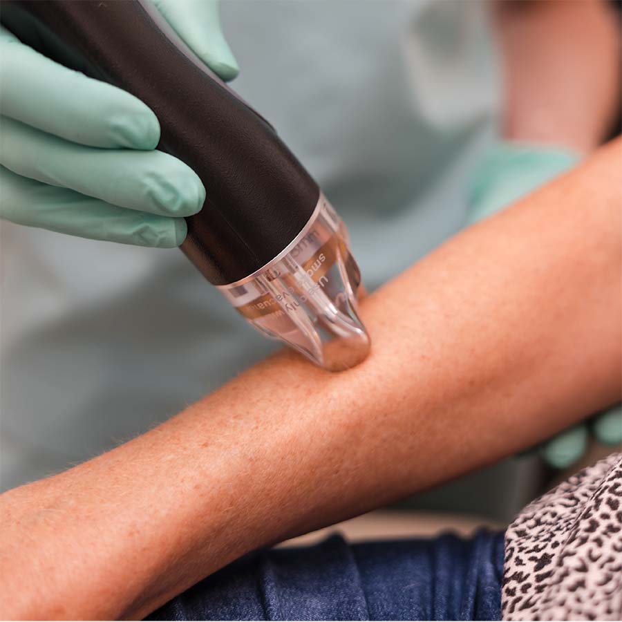 10% off laser hair removal in Lakewood Ranch Florida in September 2025