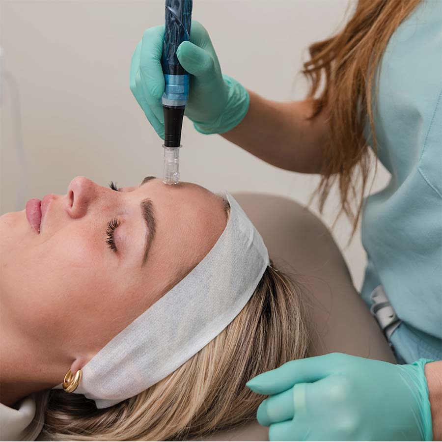 Microneedling special in Lakewood Ranch September 2025 special