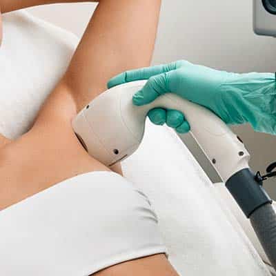 Laser Hair Removal