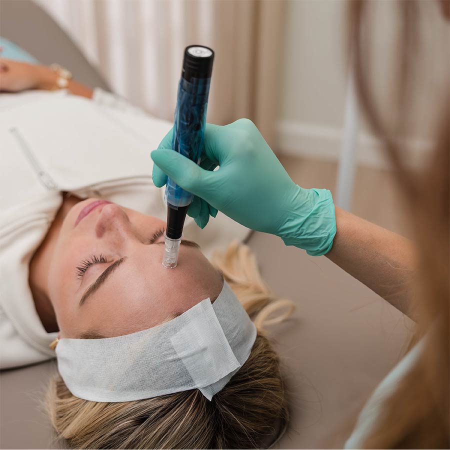 November 2025 Microneedling deal in Lakewood Ranch Florida at Arsenault Aesthetics