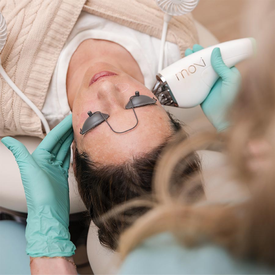 Moxi laser cyber monday deal in lakewood ranch florida 2025