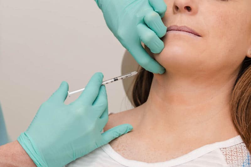 Kybella Injection