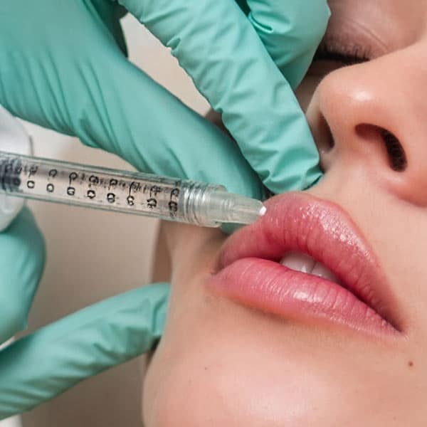 dermal fillers