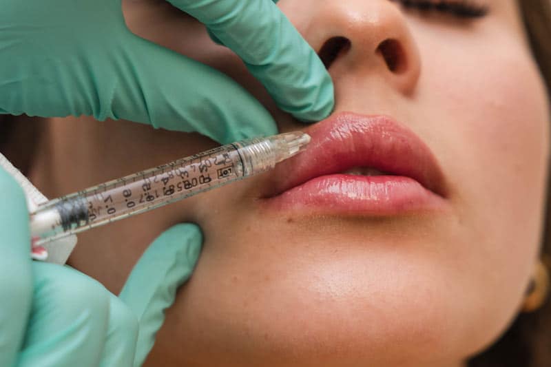 Hylenex Filler Removal Treatment