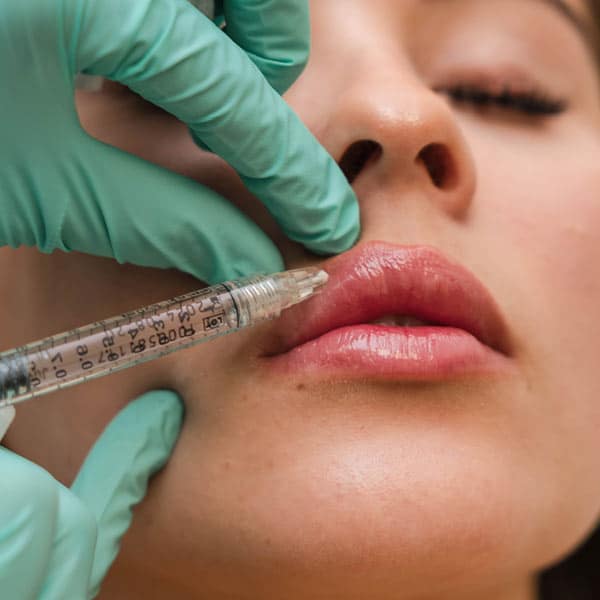 Hylenex Lip Filler Reversal Treatment