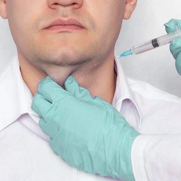 kybella for men