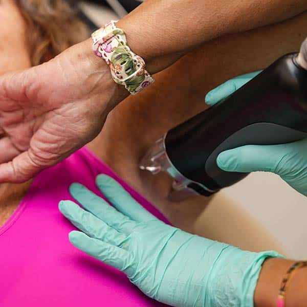 laser hair removal lakewood ranch florida