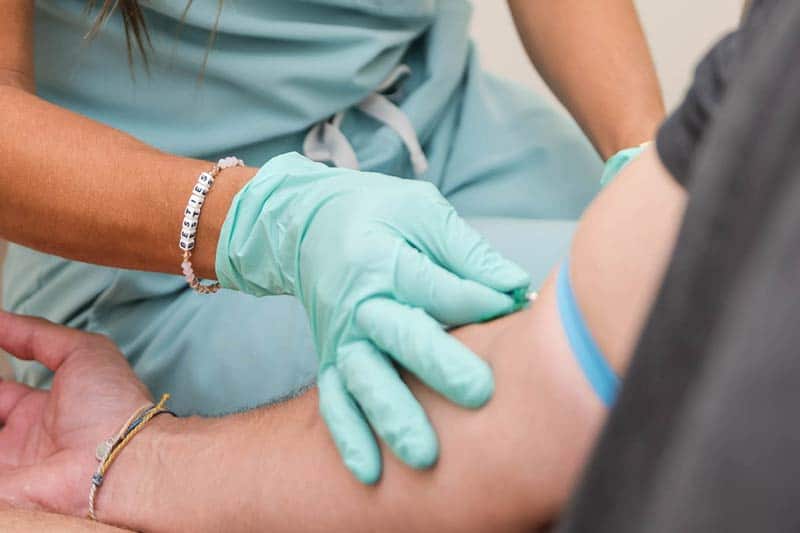 microneedling with prf