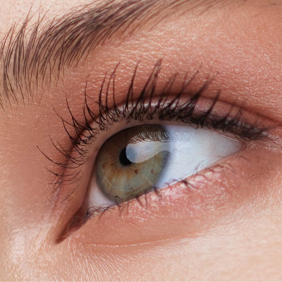 PRF Undereye Special May 2026 in Lakewood Ranch Florida