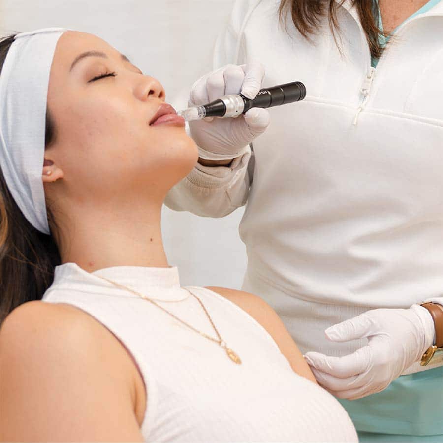 microneedling with exosomes or prf package special in lakewood ranch florida may 2026