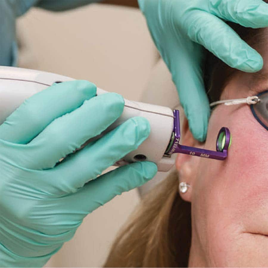 Vbeam laser special may 2026 in lakewood ranch florida