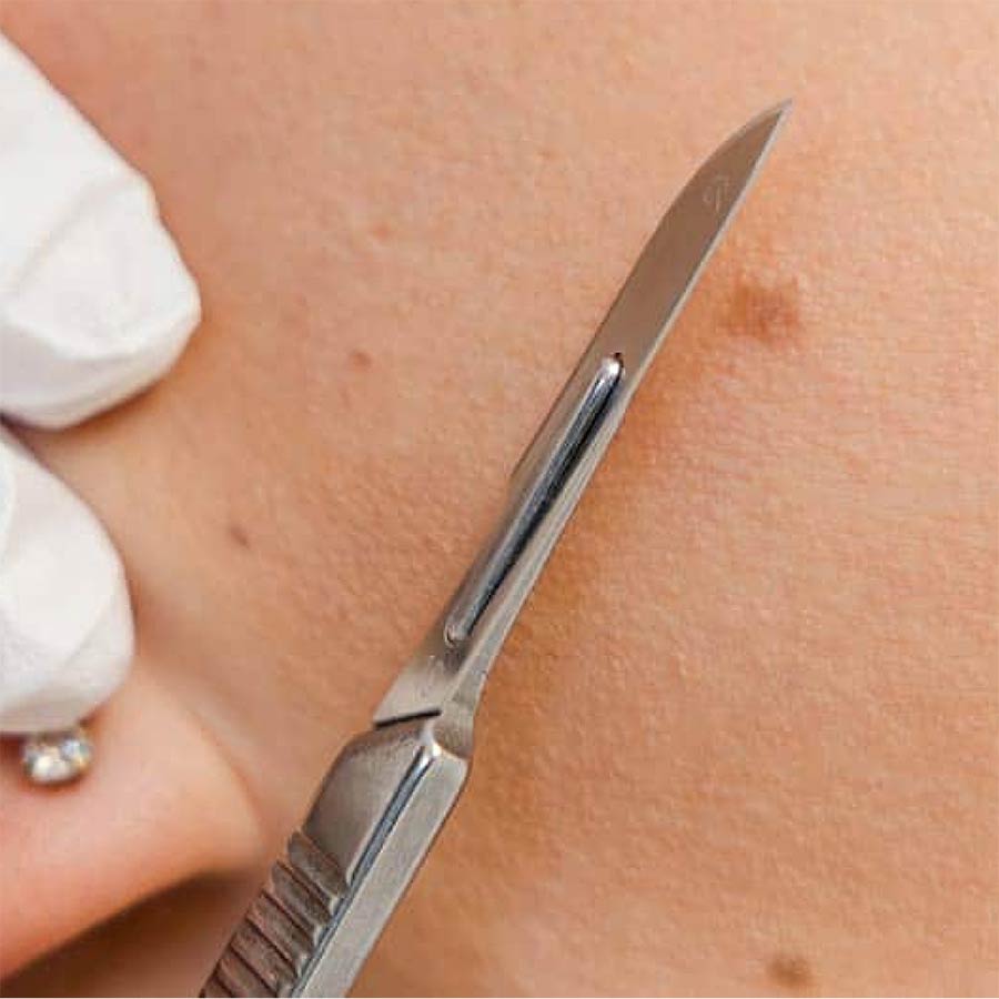 Free Dermaplane with Hydrafacial Special in Lakewood Ranch in June 2026