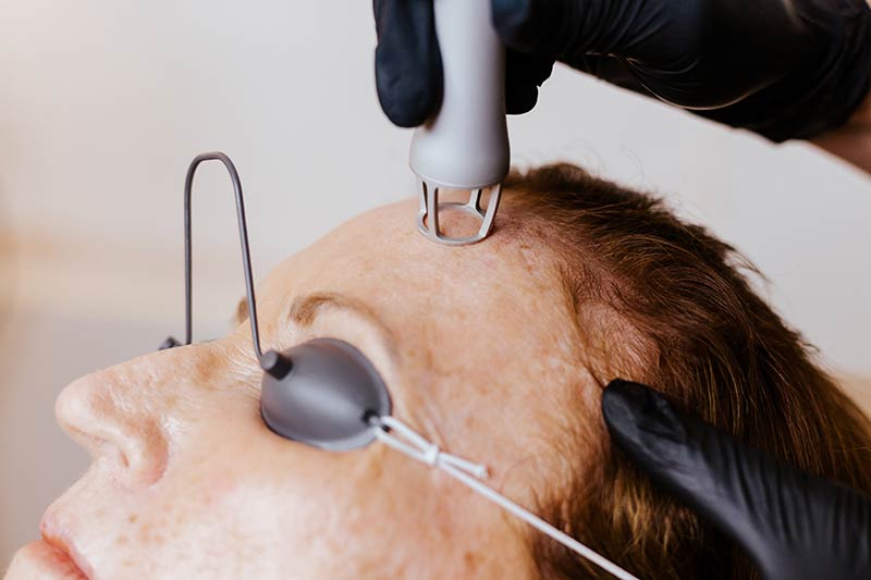 CO2RE Laser Skin Resurfacing at Arsenault Aesthetics in Lakewood Ranch Florida