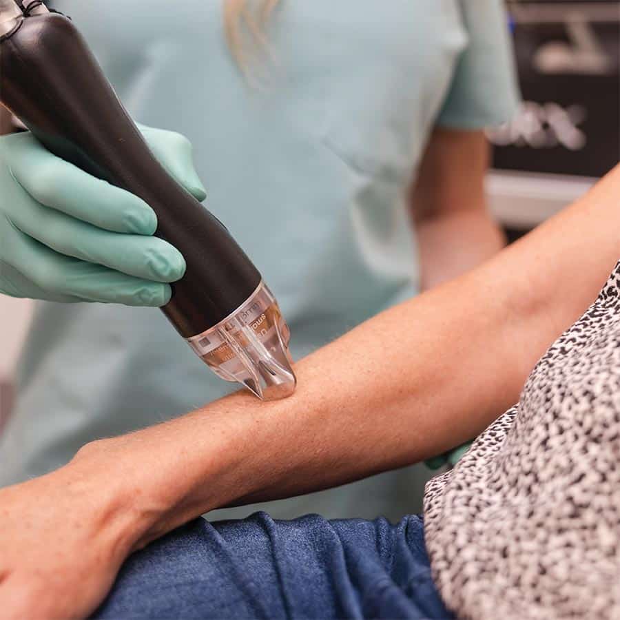 25 percent off laser hair removal packages september special in lakewood ranch florida
