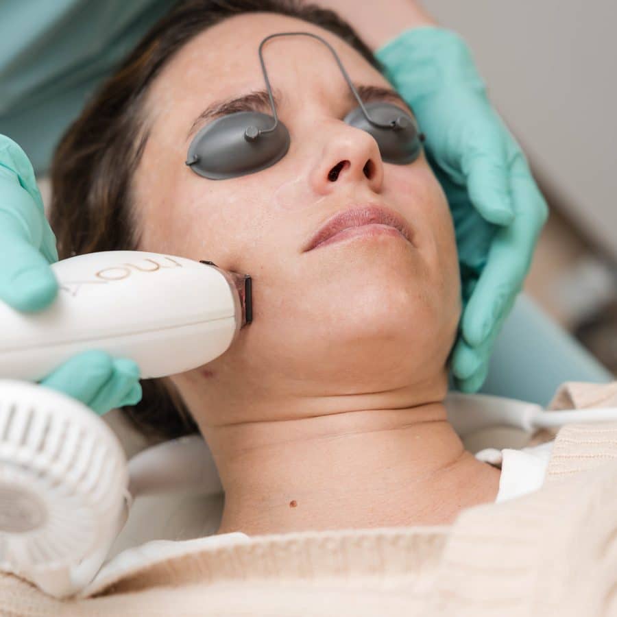 Woman wearing laser eye shields during a MOXI laser treatment for the free area MOXI package October special in Lakewood Ranch, Florida